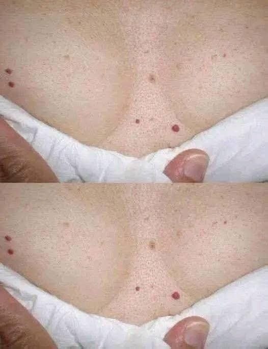 Si tienes puntos R0JOS, es una clara señal que tu cuerpo tiene c…𝐕𝐞𝐫 𝐦á𝐬